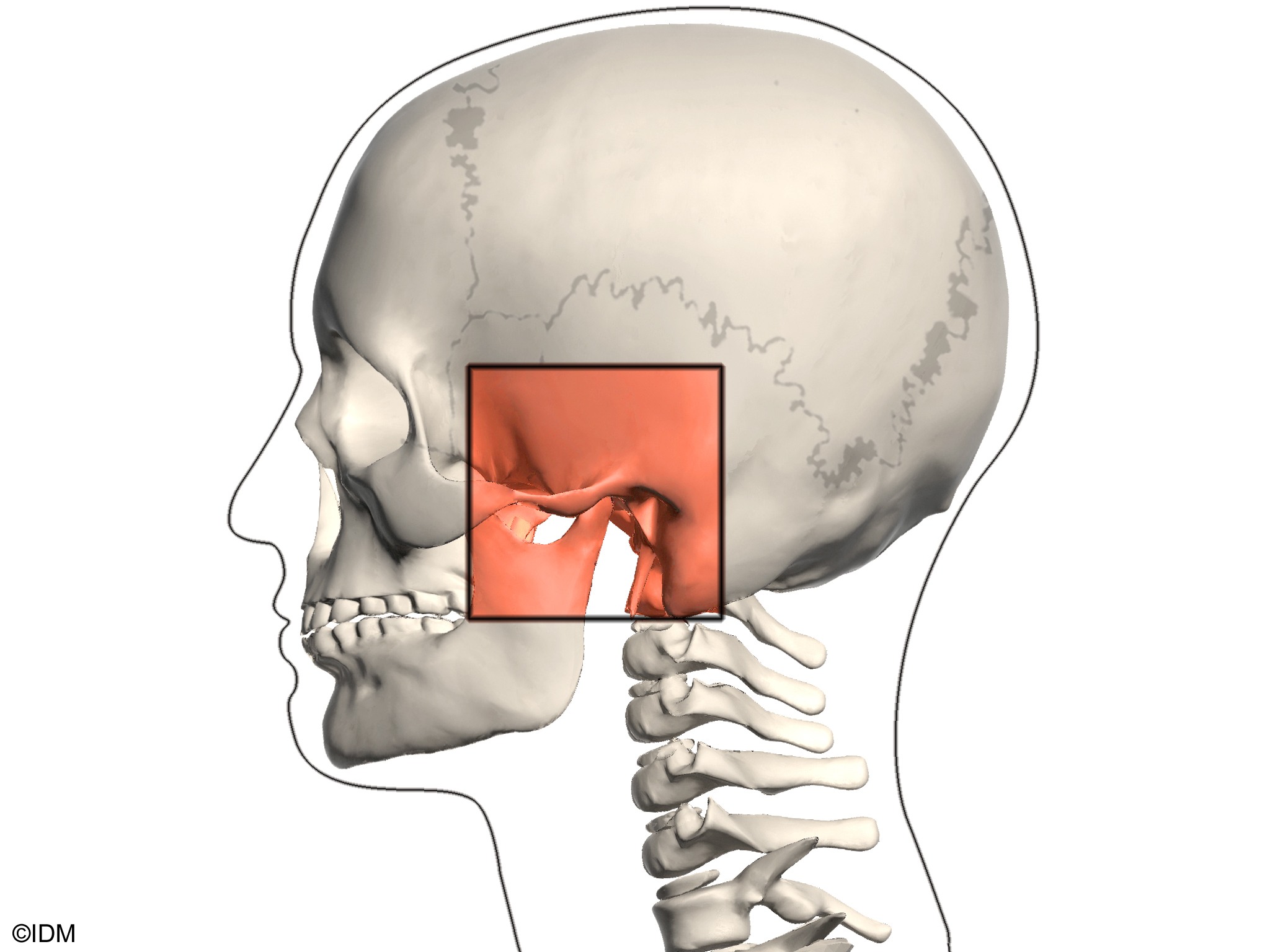 Болит челюсть при открытии возле уха. Анкилоз височно-челюстного сустава. Дисфункция челюстного сустава. Челюстно лицевой сустав.